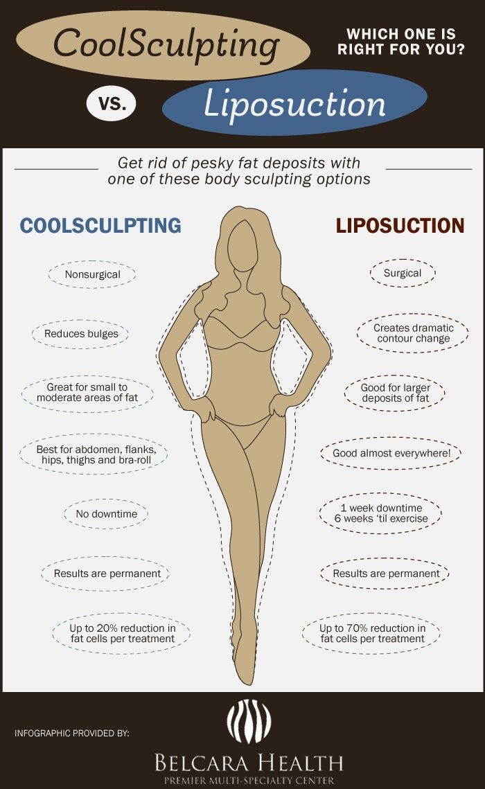 Comparison infographic of CoolSculpting and Liposuction.