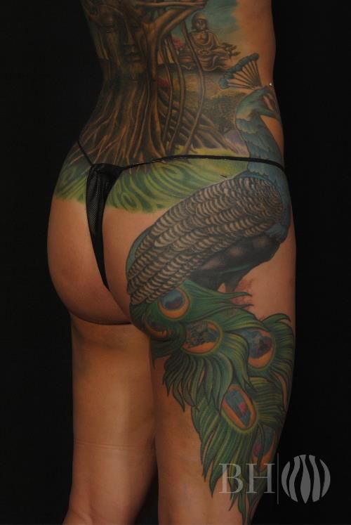 Buttock Augmentation Before & After